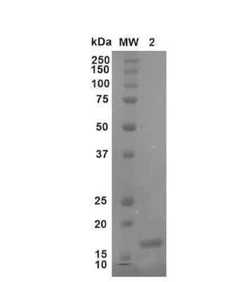 SDS-Page: Recombinant Human beta-Synuclein Active, Monomer Protein [NBP3-14775] - Coomassie gel stain of Human Beta Synuclein Monomer (NBP3-14775). Load: 2 ug.